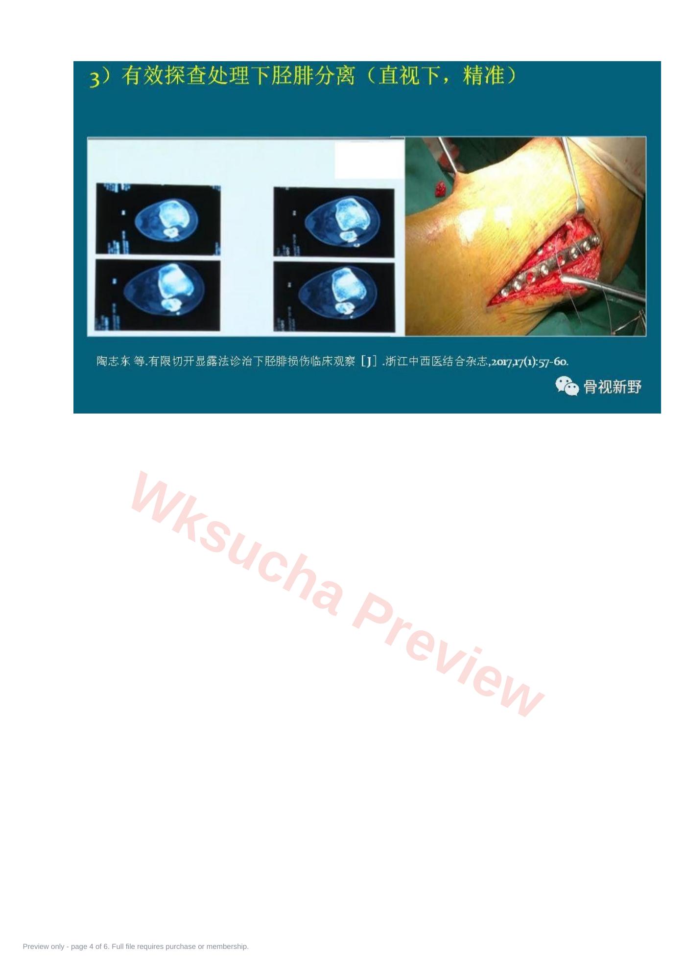 预览第 4 页