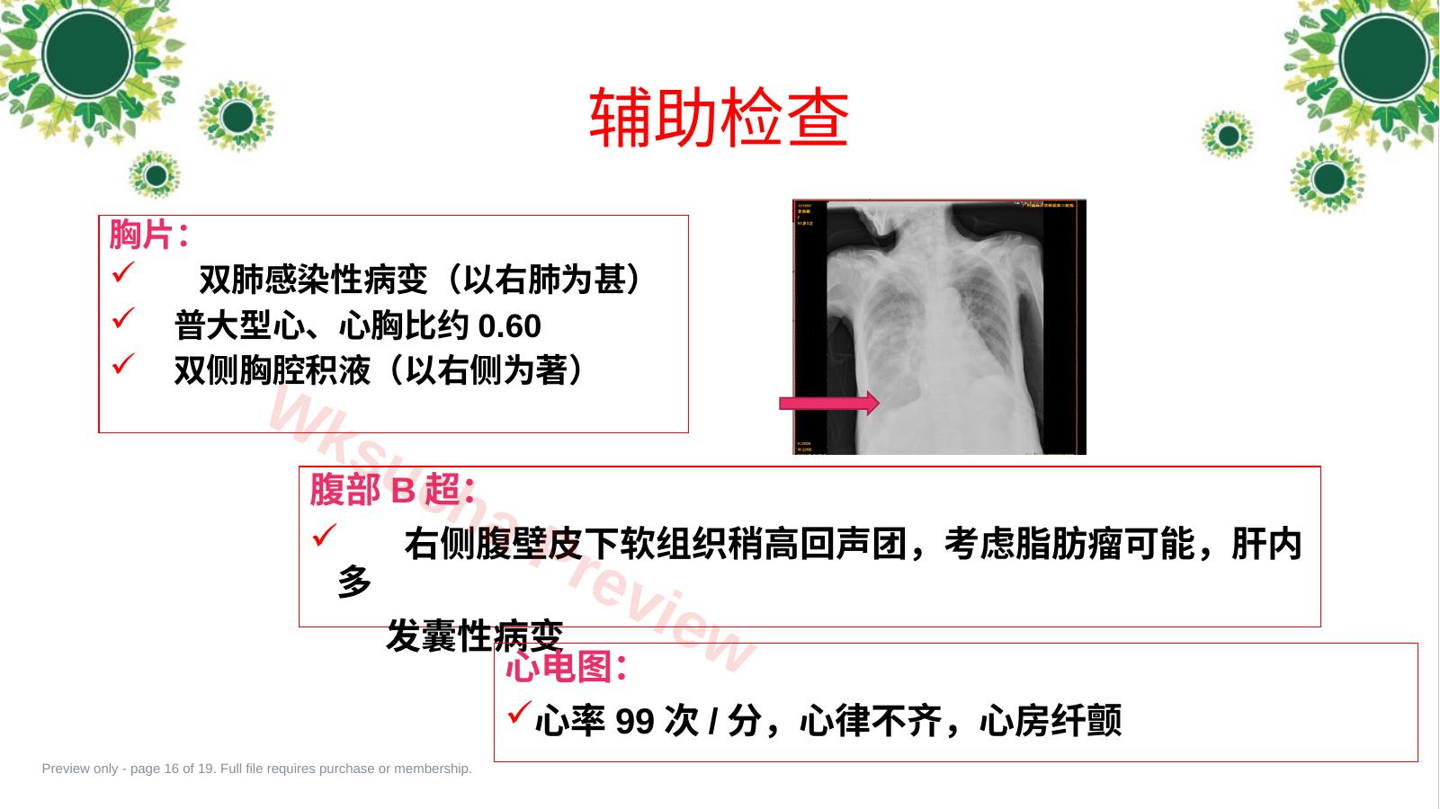 预览第 16 页