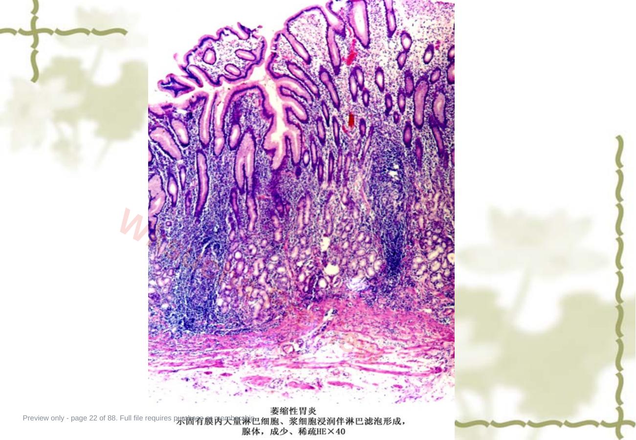 预览第 22 页