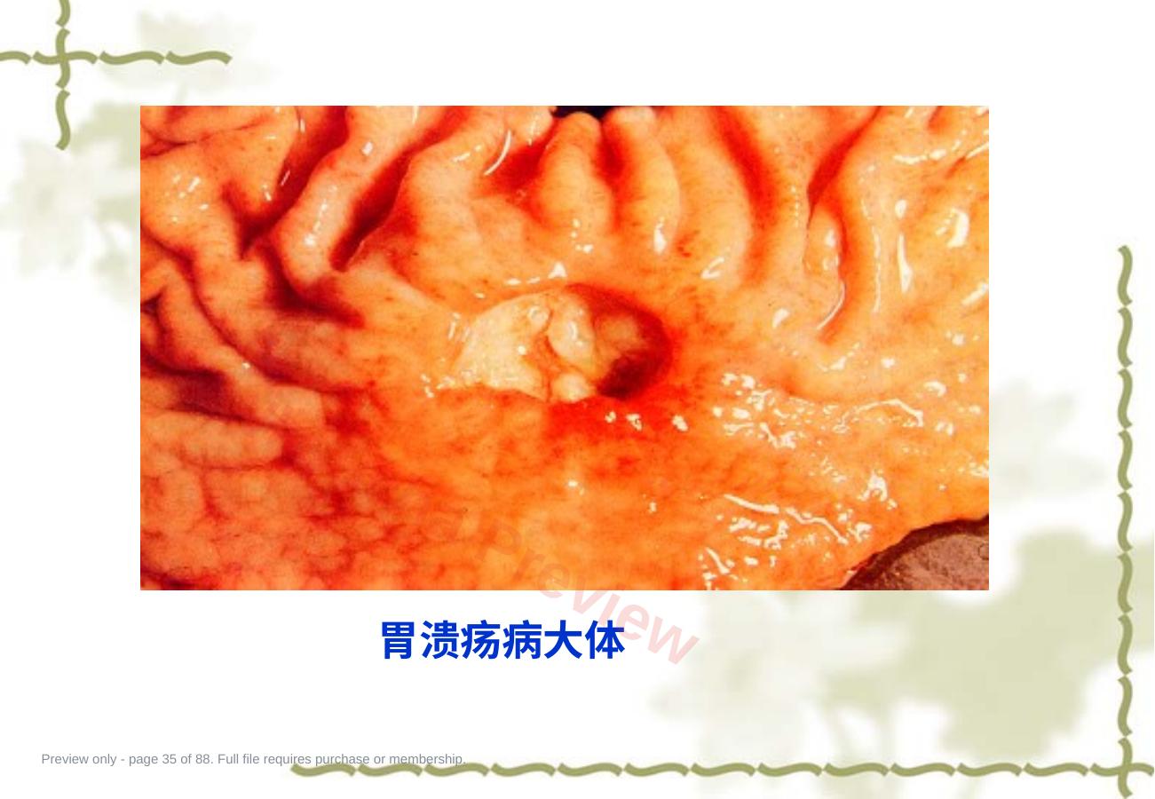 预览第 35 页