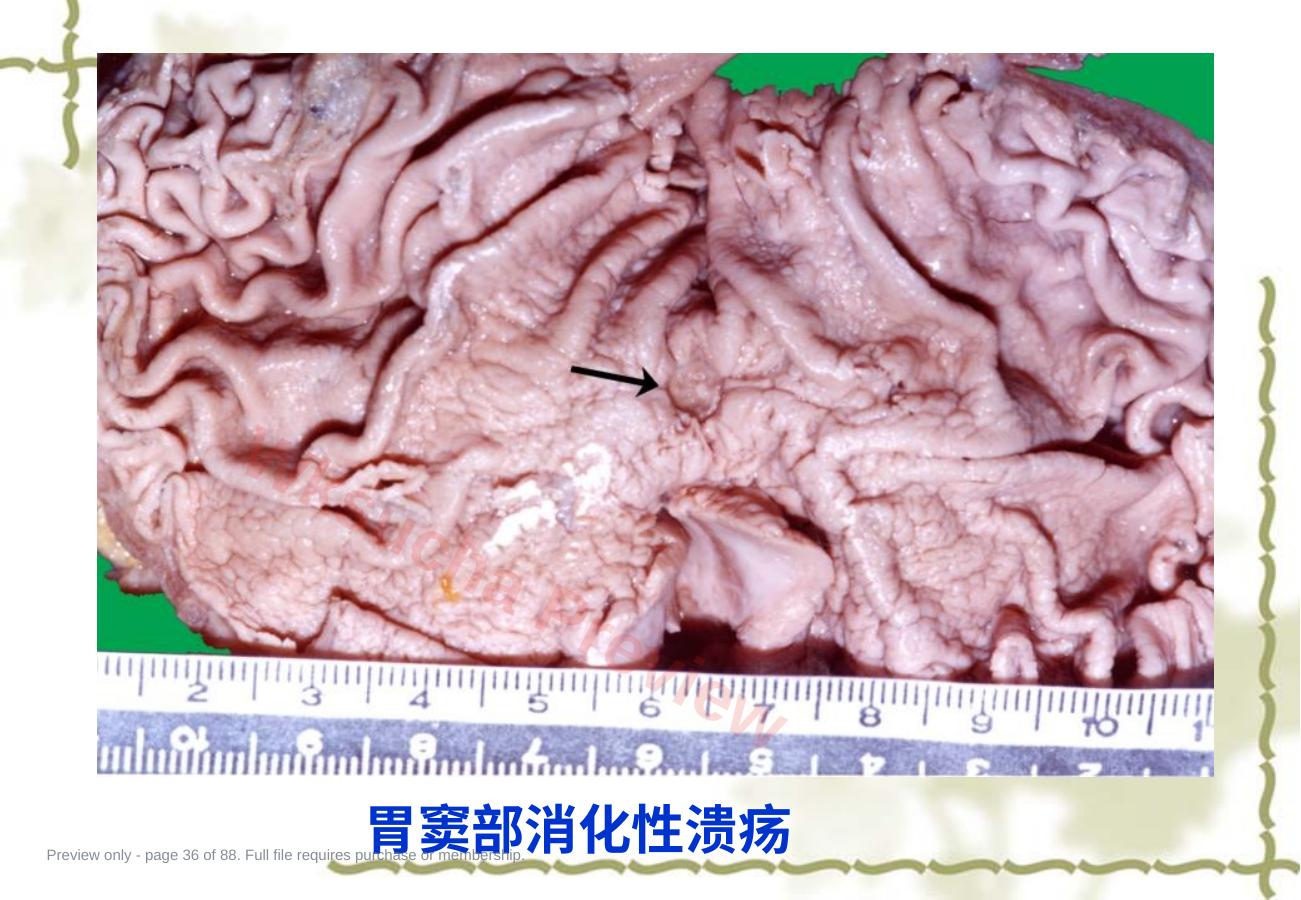 预览第 36 页