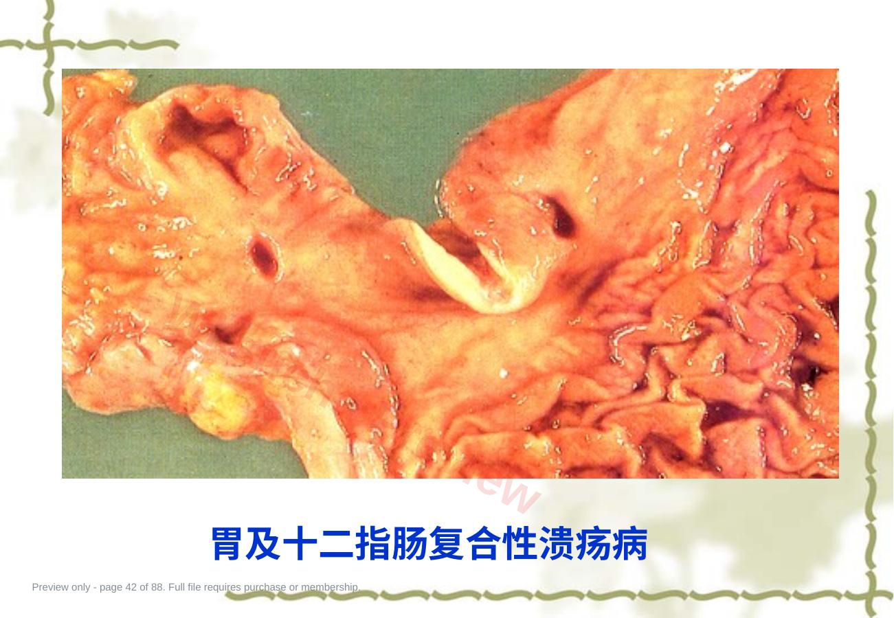 预览第 42 页