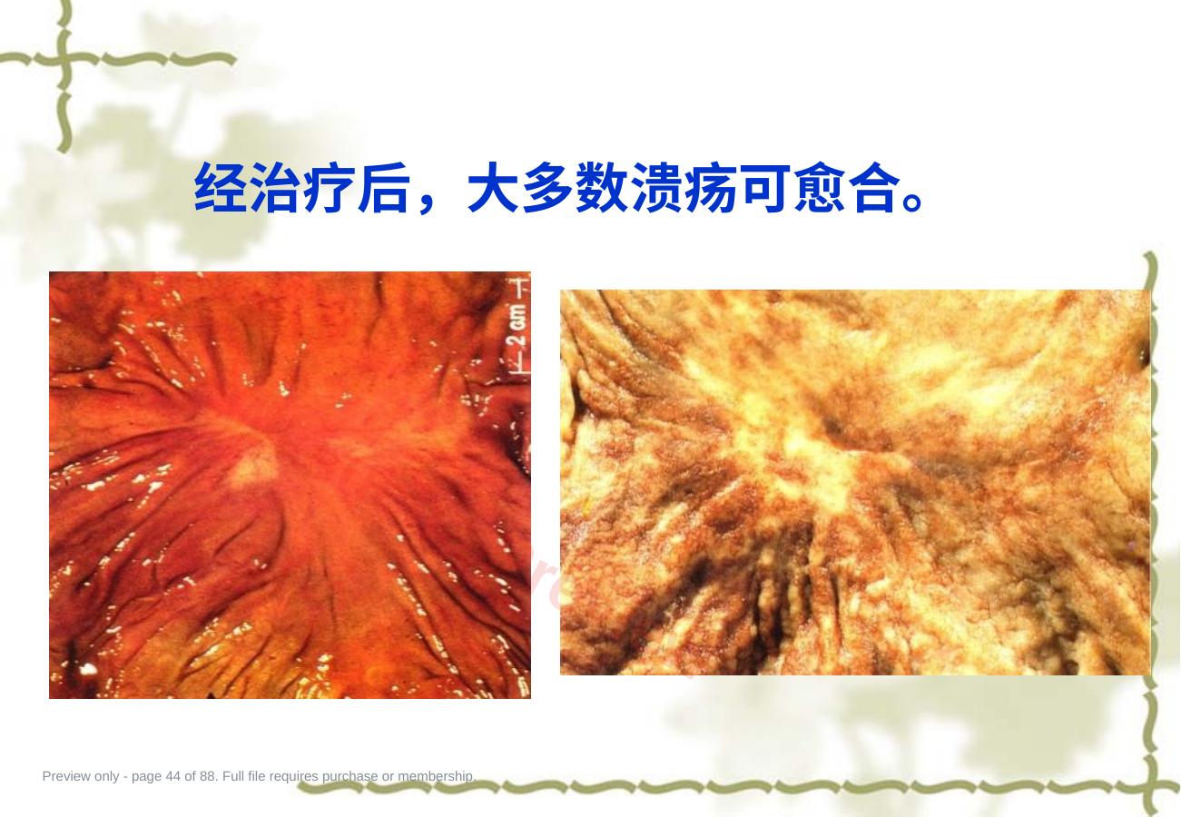 预览第 44 页
