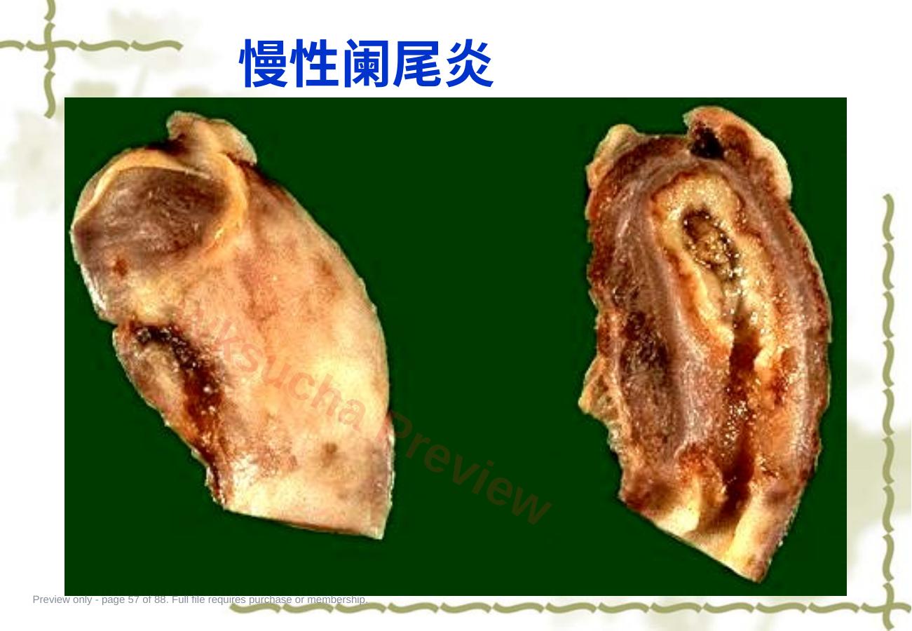 预览第 57 页
