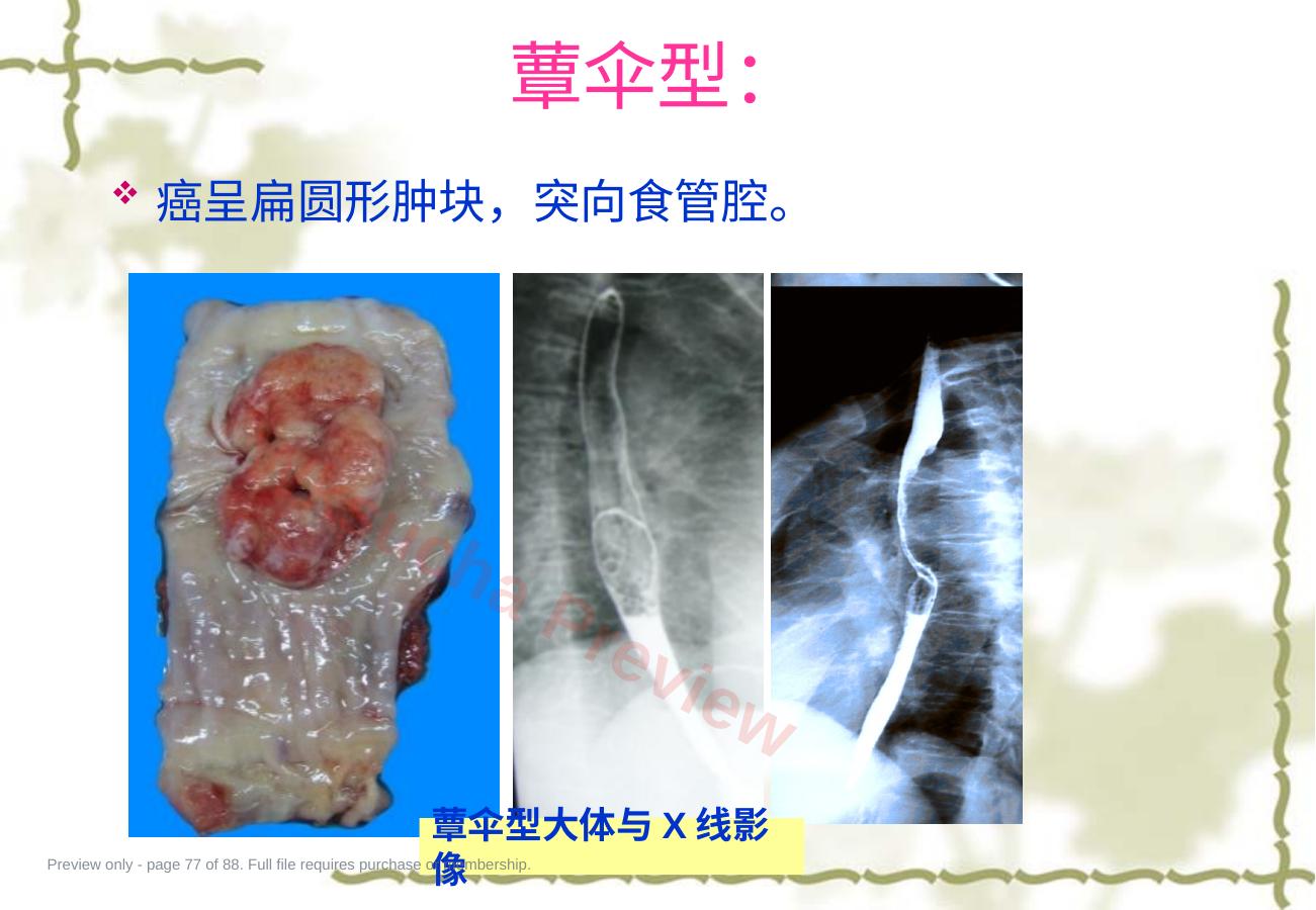 预览第 77 页