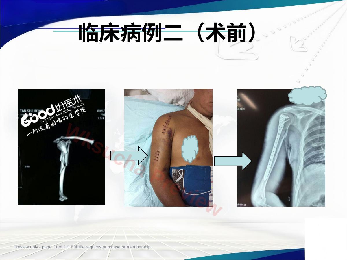 预览第 11 页