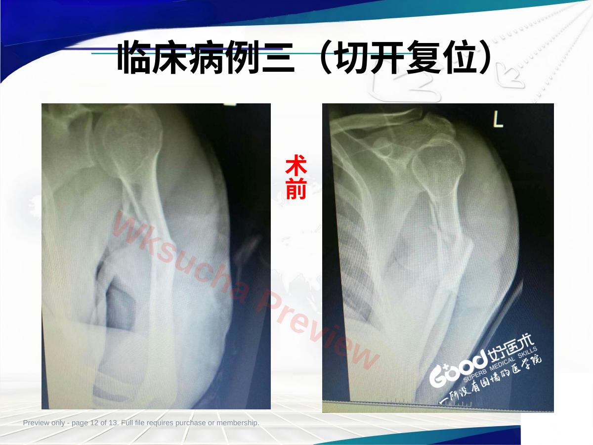 预览第 12 页