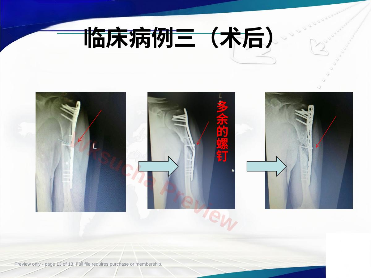 预览第 13 页