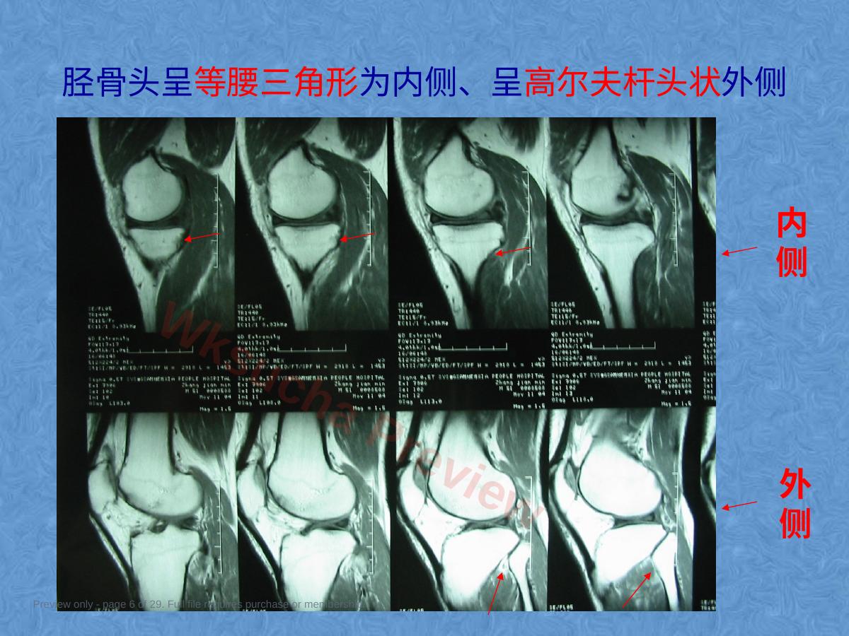 预览第 6 页