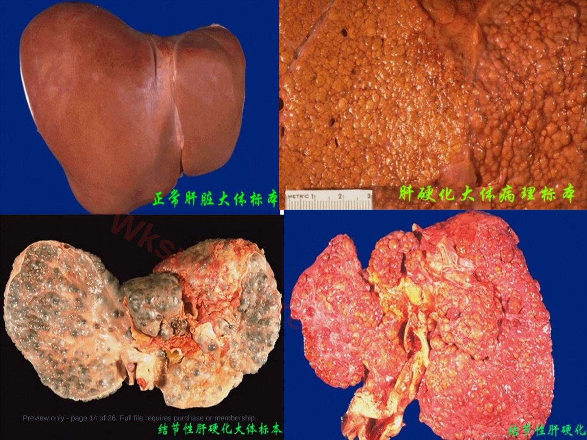 预览第 14 页