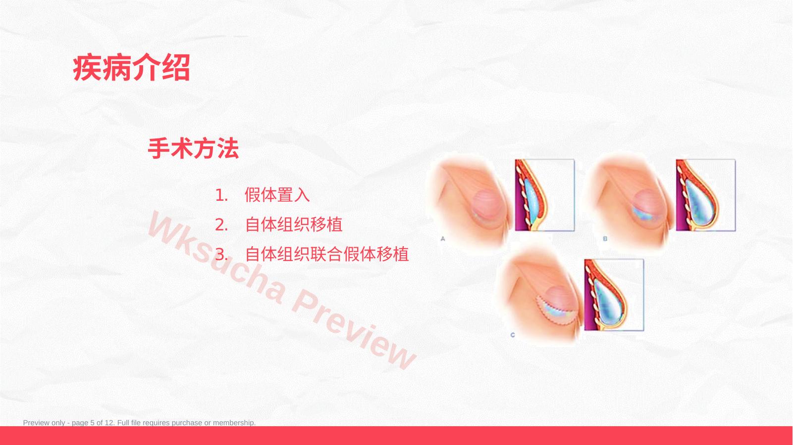 预览第 5 页