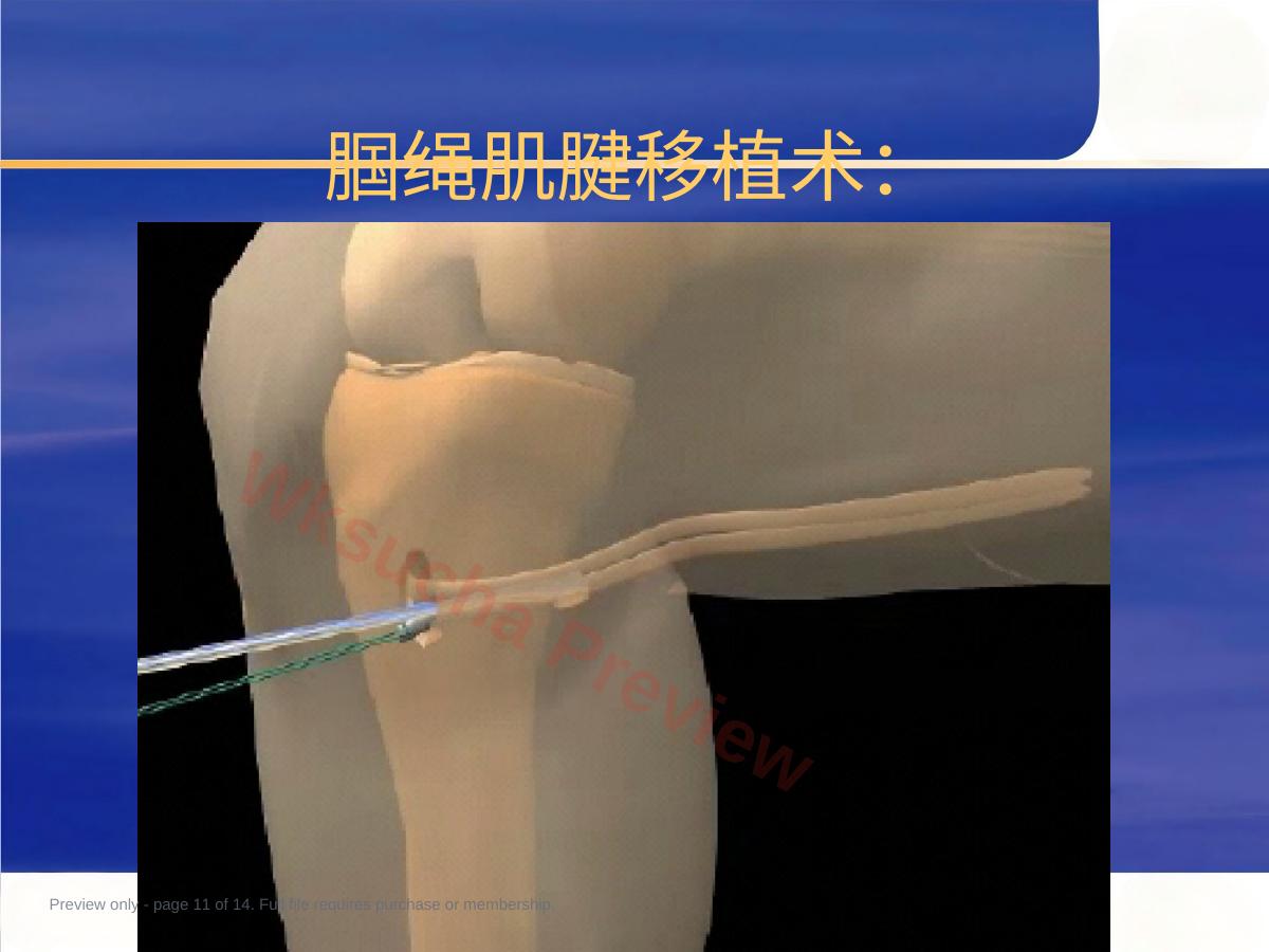 预览第 11 页