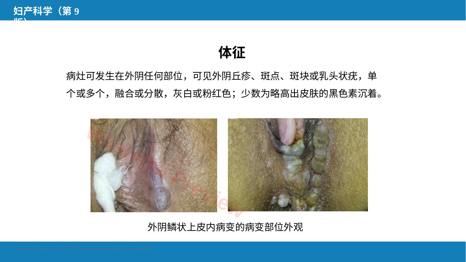 预览第 11 页