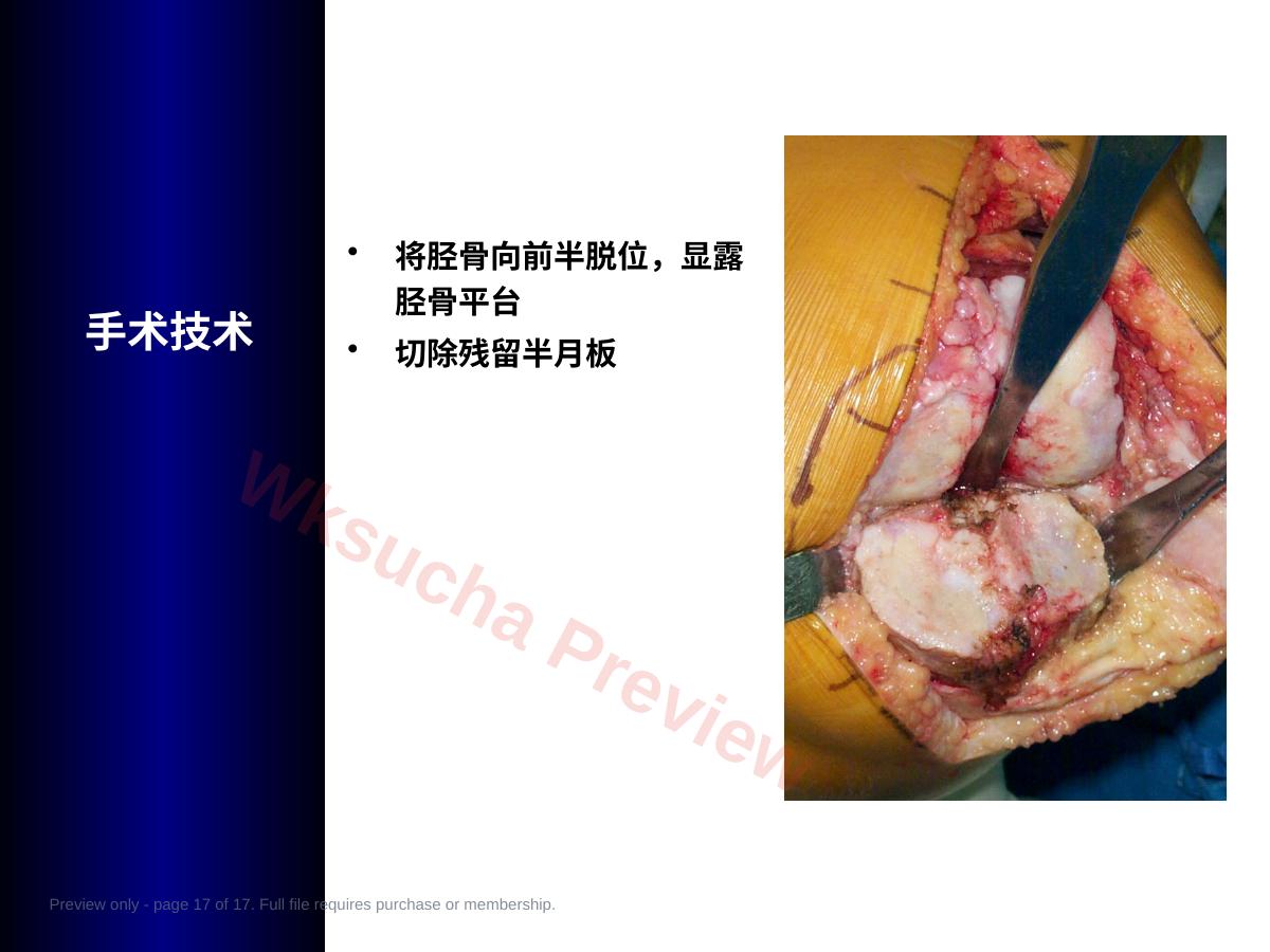 预览第 17 页