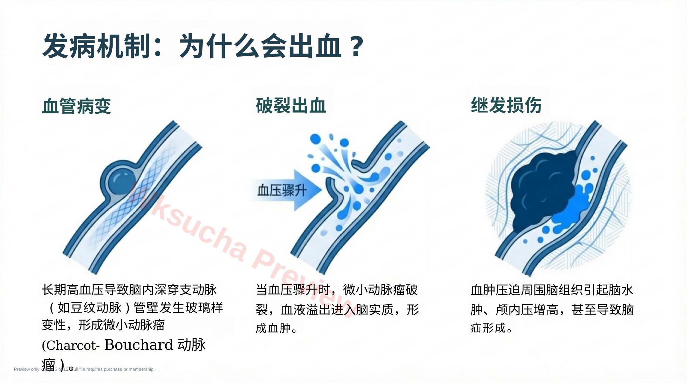 预览第 5 页