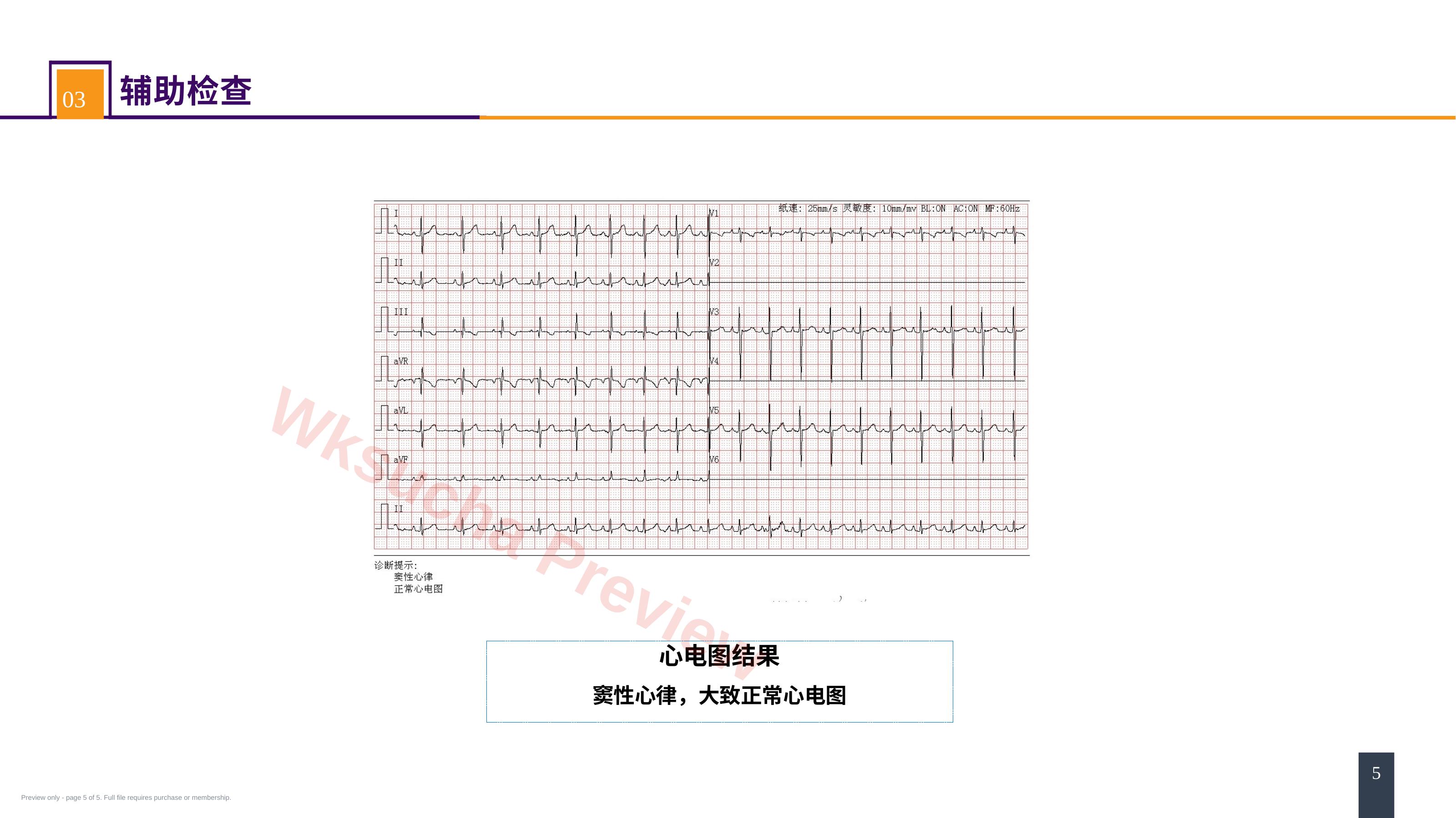 预览第 5 页