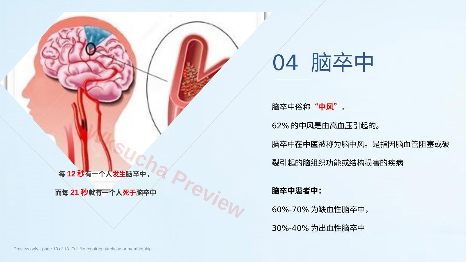 预览第 13 页