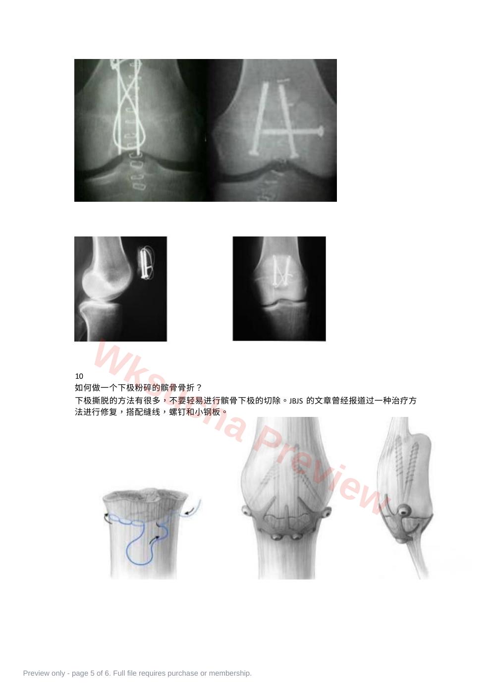 预览第 5 页
