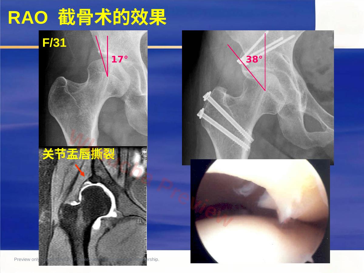 预览第 16 页