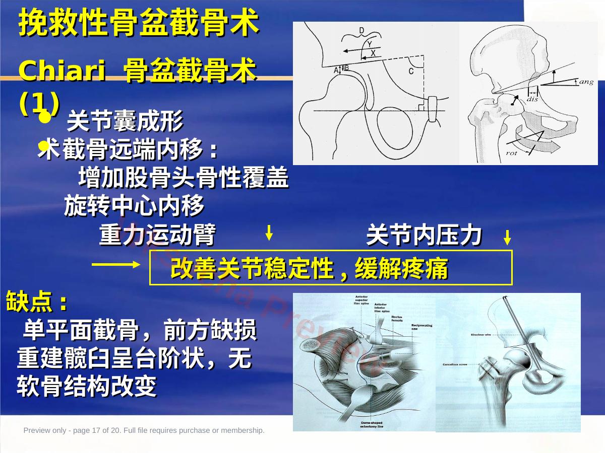 预览第 17 页