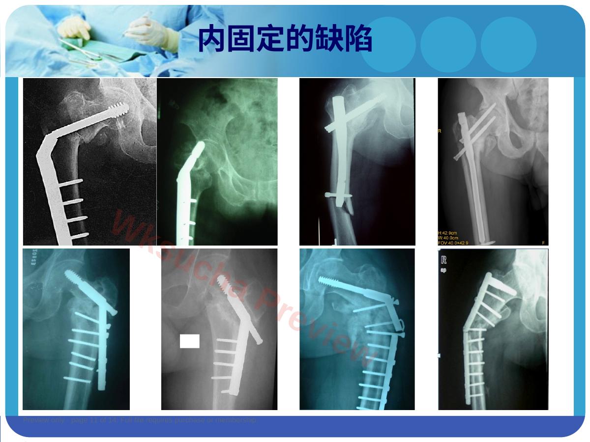 预览第 11 页
